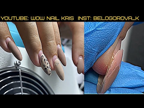 Видео: Ногти висят на со**ях| Кардинальная перемена- очень жалко 😱