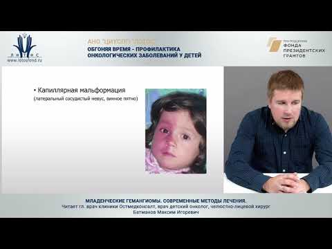 Видео: Младенческие гемангиомы. Современные методы лечения.