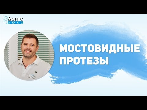 Видео: Показания, плюсы и минусы, виды и срок эксплуатации мостовидных протезов