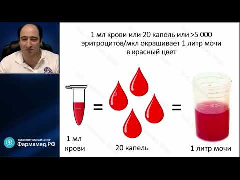 Видео: Кровь в моче или гематурия?