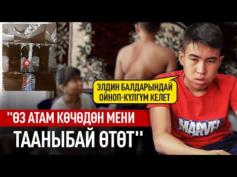 Видео: "Кичине кезимде ооруканада атамды күтчүмүн" дейт 15 жаштагы Саламат
