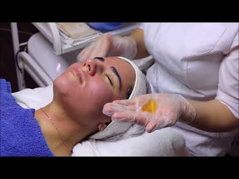 Видео: Атравматическая чистка лица ложкой УНО на косметике Holy Land / Чистка пор от акне