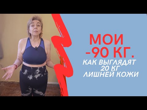 Видео: МОИ МИНУС 90 кг. Как выглядит 20 кг. лишней кожи?