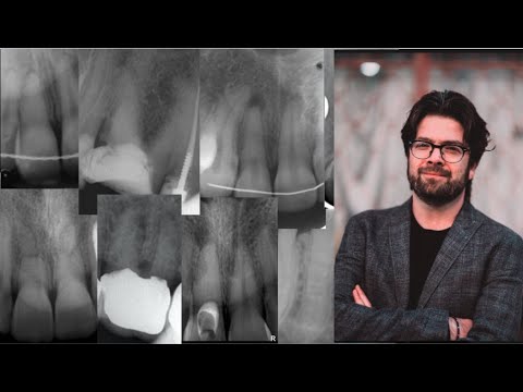 Видео: Непроходимые каналы