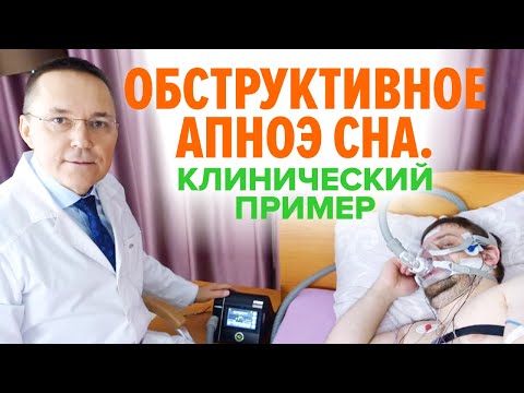 Видео: Обструктивное апноэ сна. Клинический пример / Отзыв