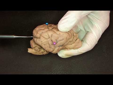 Видео: Конечный мозг