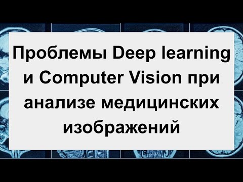 Видео: Проблемы Deep learning и Computer Vision при анализе медицинских изображений