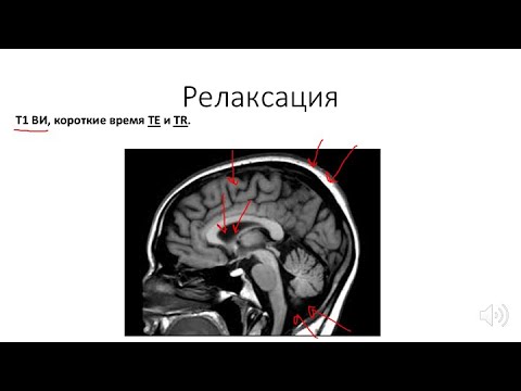 Видео: Основы МРТ(ЧАСТЬ 2).  T1 и T2 ВИ, матрица и FOV.