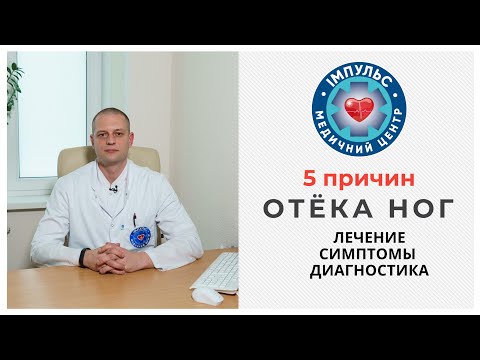 Видео: 5 причин отёка ног - что делать и как лечить