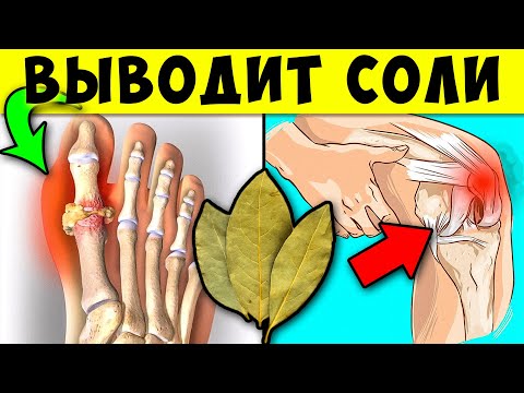 Видео: Целые комки Соли выйдут Из Суставов, если Каждый день пить по два глотка