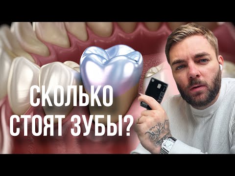 Видео: Сколько стоит реставрация зубов у Виктора Щербакова?