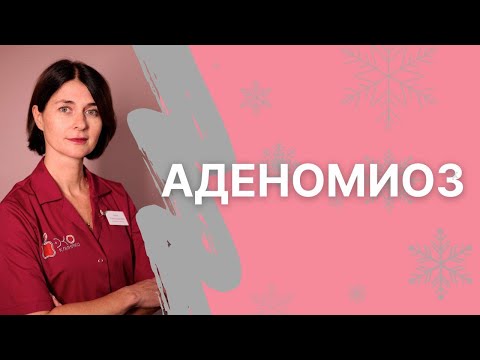 Видео: Аденомиоз