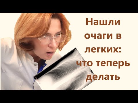 Видео: Очаги в легких