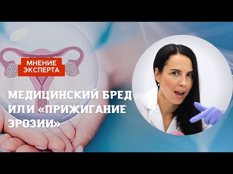 Видео: ПОЧЕМУ НЕЛЬЗЯ ПРИЖИГАТЬ ЭРОЗИЮ и лечить папилломавирус?