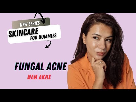 Видео: АКНЕ или ГЪБИЧНА инфекция (a.k.a. FUNGAL ACNE )/ 5 признака и лечение/ СПФ ГУРУ