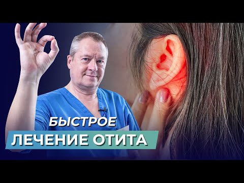 Видео: Как лечить отит: эффективные способ избавления от болей в ухе