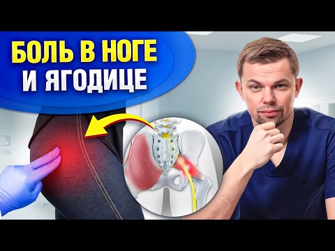 Видео: Боль в ягодице, пояснице и ноге — ЭТО НЕ СИНДРОМ ГРУШЕВИДНОЙ МЫШЦЫ