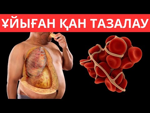 Видео: Қантамырдағы Ұйыған ҚАНДЫ тез ерітетін ТОП 5 тағам. Қан тамыр аурулары