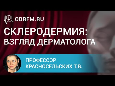 Видео: Профессор Красносельских Т.В.: Склеродермия: взгляд дерматолога