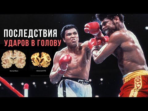 Видео: Как удары влияют на мозг? Последствия бокса и футбола