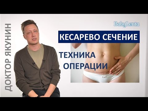Видео: Как делают кесарево сечение? Как проходит кесарево сечение подробно?