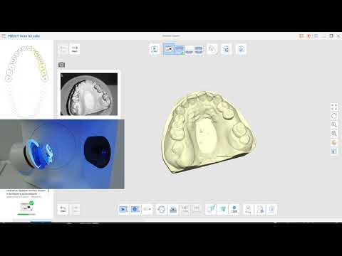 Видео: 1часть: CAD\CAM. 3D cканирование в Medit, EXOCAD моделирование. Временные конструкции и 3D печать.