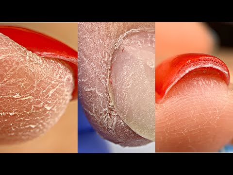 Видео: ПАЛЬЦЫ СУХАРИ😱Маникюр на клиенте💅Комбинированный маникюр