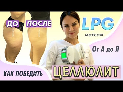 Видео: LPG массаж от целлюлита / Все, что вы хотели знать про LPG и целлюлит
