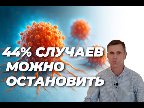 Видео: 44% случаев рака можно предотвратить — как именно?