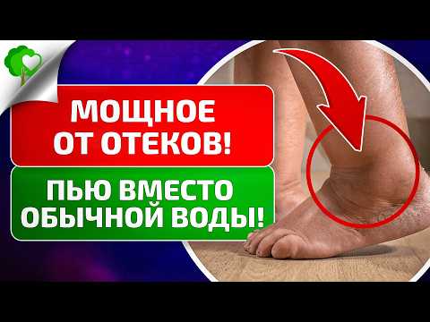 Видео: Мочегонные — не выход! Как убрать отеки и нормализовать давление без вреда для организма