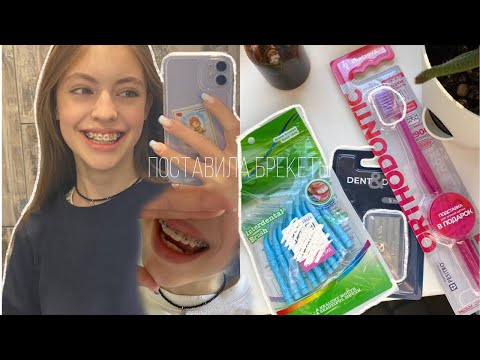 Видео: тихий влог🤍 : ставлю брекеты🦷/первые ощущения и дни/что я кушала?