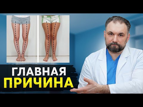 Видео: Перестань ЭТО делать! Причина появления О и Х образных ног!