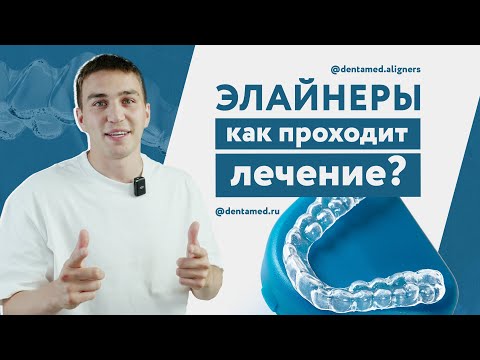 Видео: Элайнеры. Как проходит лечение?