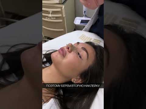 Видео: Тейпирование после Рино/РиноСептопластики