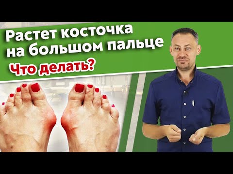 Видео: Hallux valgus / Почему торчат косточки на пальцах ног?