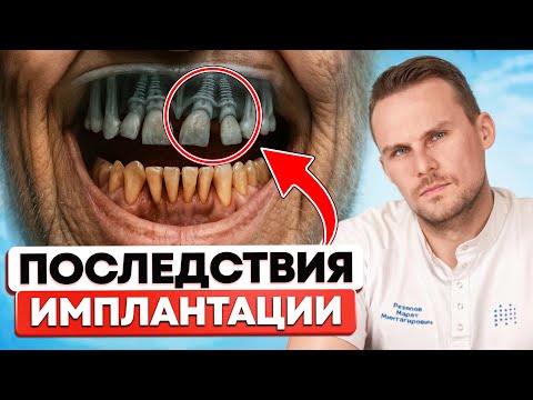 Видео: НЕ СОГЛАШАЙТЕСЬ НА ИМПЛАНТЫ! Последствия о которых молчат врачи
