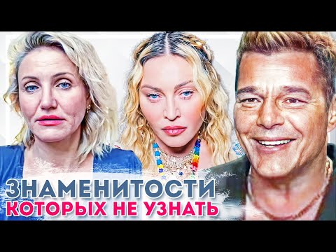 Видео: Голливудские звёзды, которыми мы раньше восхищались, а теперь их не узнать