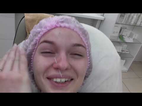 Видео: Пирсинг носа. Салон Эстетика Мед. Новокузнецк