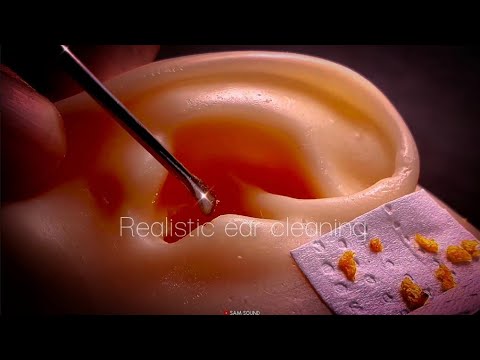 Видео: ASMR Если закрыть глаза и слушать, то это более реалистично❤️Удаление твердой ушной серы Чистка ушей