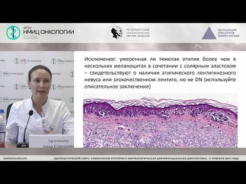 Видео: Диспластический невус: гистологическая дифференциальная диагностика (Артемьева А.С.)