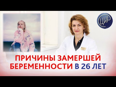 Видео: HLA-гены, причины невынашивания и планирование беременности после замершей в 26 лет.