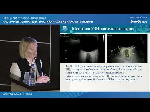 Видео: УЗИ зрительного нерва в диагностике внутричерепной гипертензии. Андрейцева М.И.