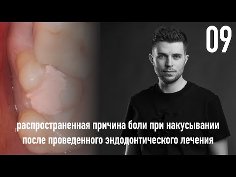 Видео: Уроки эндодонтии. Распространенная причина боли при накусывании после проведенного лечения