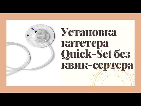 Видео: Как установить катетер квик-сет руками(без установочника).Полная инструкция с демонстрацией