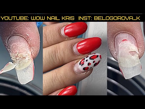 Видео: Бешенный рост кутикулы|Ничего не держится,что делать?Отслойки ВЕЗДЕ!Продолжение треш истории этих💅