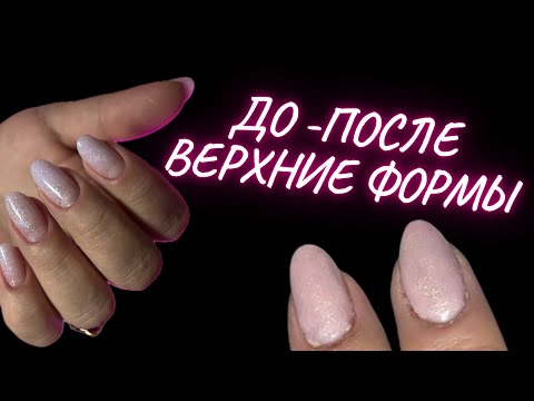 Видео: ВЕРХНИЕ ФОРМЫ БЕЗ ЗАТЕКОВ | ПРОПИЛЫ В МАНИКЮРЕ | КОРРЕКЦИЯ НОГТЕЙ