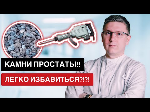 Видео: Камни простаты! Так ли легко от них избавится?!?!