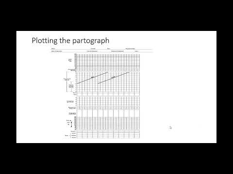Видео: технические проблемы с партографом