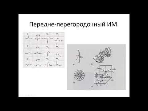 Видео: Рогатова А.Н. "ЭКГ при ИБС" Часть 2 (27.10.2023)