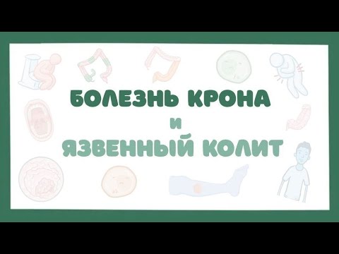 Видео: Болезнь Крона - причины, симптомы, лечение (лекция)